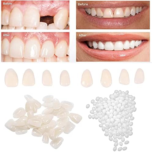 ערכת תיקון שיניים-חרוזים מתאימים תרמיות ושיניים מזויפות לתיקון זמני שן חסרה ושבורה